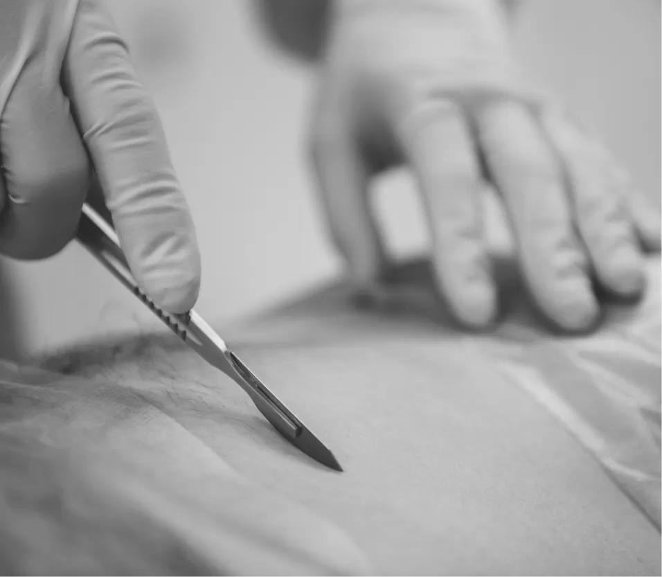 A gloved surgeon holding a scalpel over a patient's skin