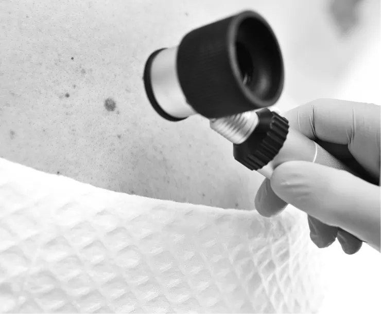 A clinician examining a patient's skin with a dermatoscope
