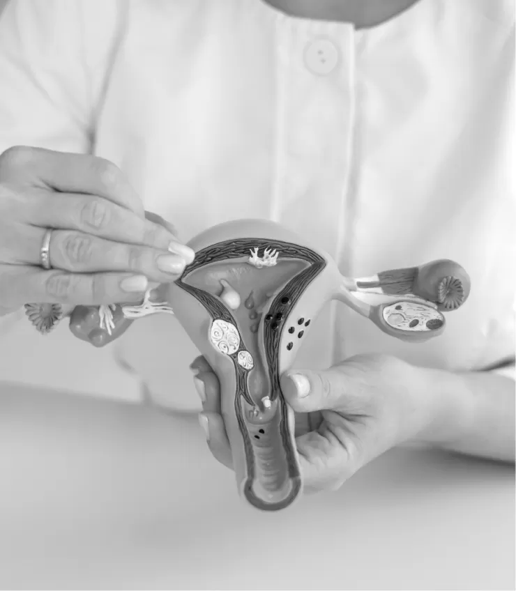 A clinician holding an anatomical model of the uterus and ovaries