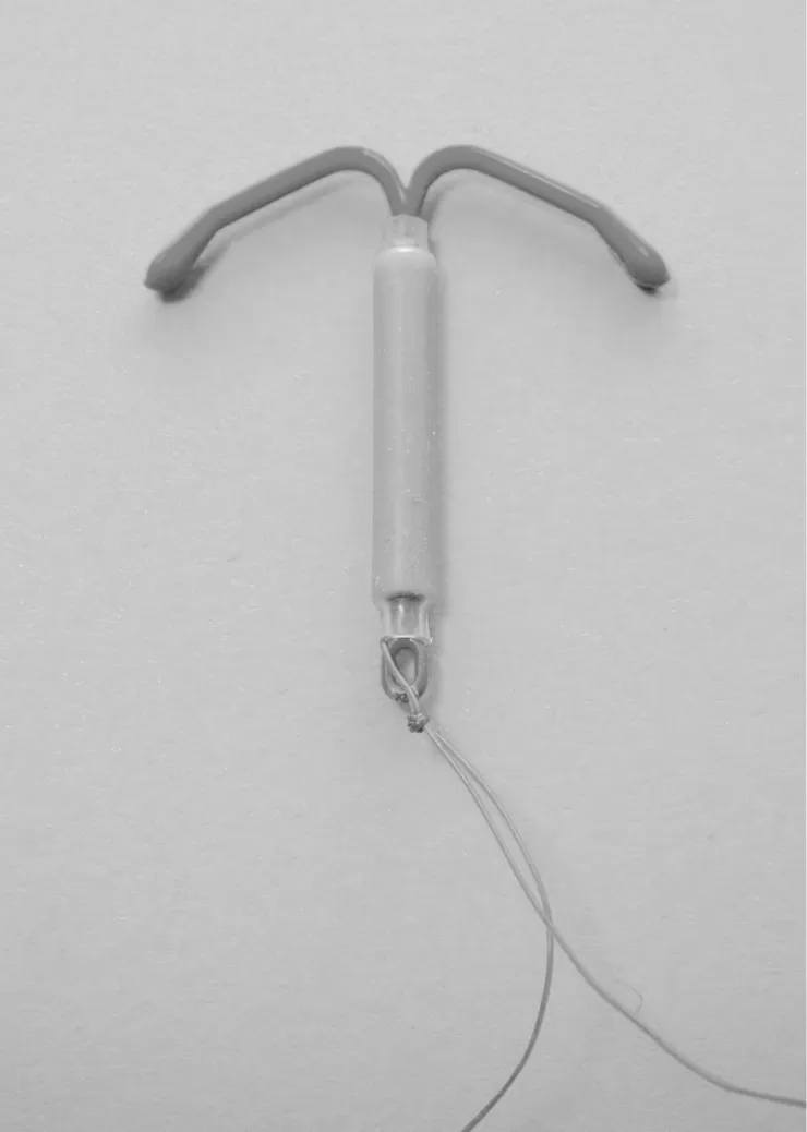 A hormonal intrauterine device