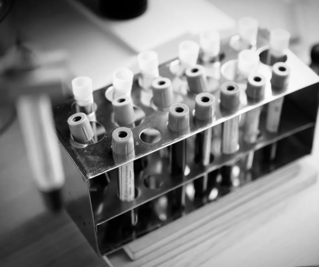 A rack of blood collection tubes in the on-site pathology room