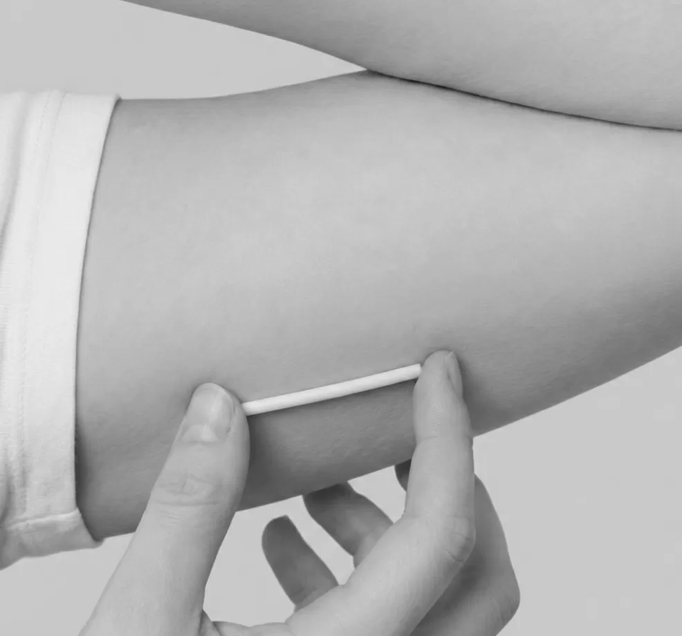 A clinician holding a contraceptive implant applicator against a patient's upper arm
