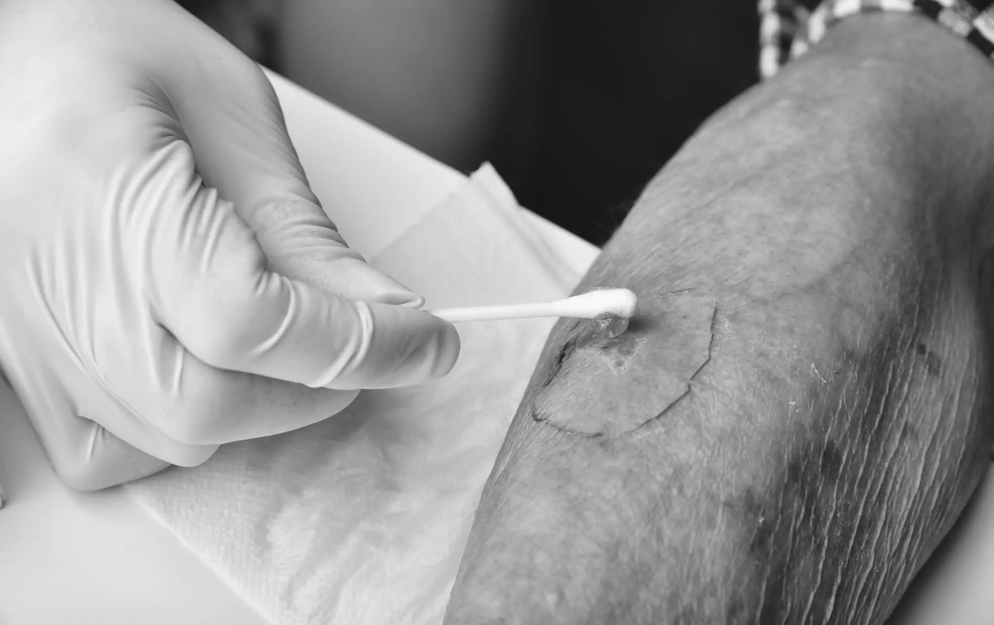 A gloved clinician cleaning a wound on a patient's arm with a swab